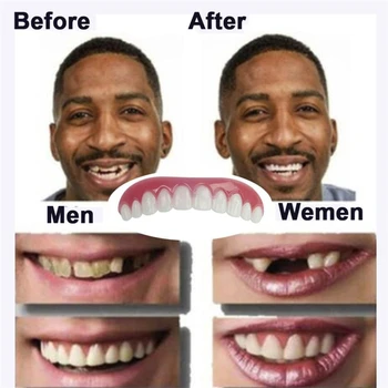 2vnt Dantų Laminatės Comfort Fit Flex Kosmetikos Dantų Protezų, Dantų Viršų Kosmetikos Fanera, Polietileno Dentaduras Dentes Falsos